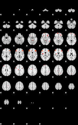 Patients 29151 29