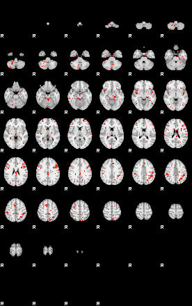 Patients 29633 6