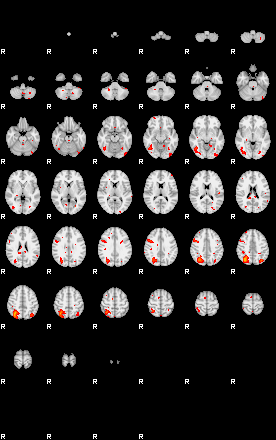 Patients 29162 20