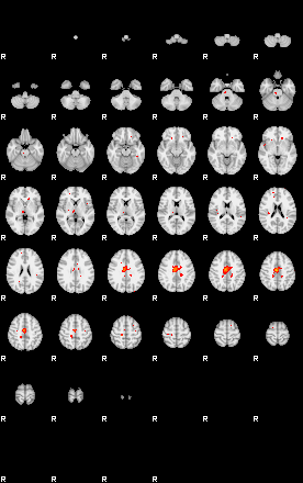 Patients 29170 185