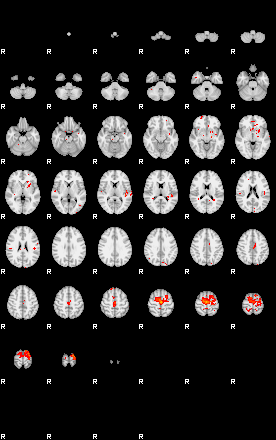 Patients 29052 80