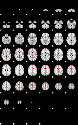 Patients 29107 55