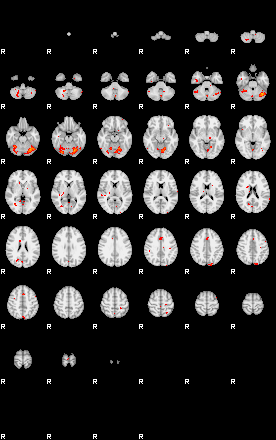 Patients 28690 51