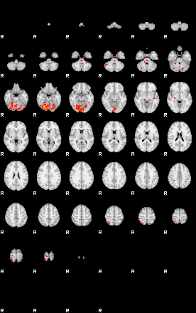 Patients 29401 70