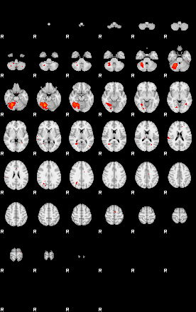 Patients 29107 112