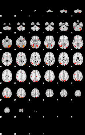 Patients 29203 24