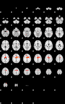 Patients 29503 180