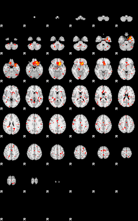 Control:20;component:144