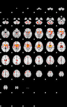 Control:30;component:174