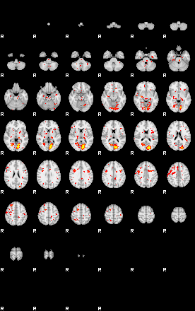 Control:48;component:181