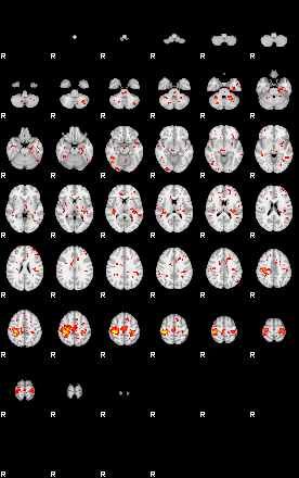 Control:81;component:178