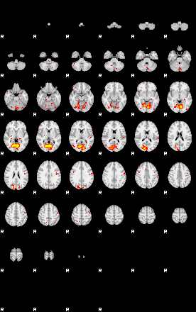 Control:81;component:181