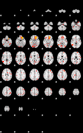 Control:82;component:144