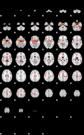 Control:84;component:163