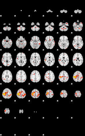 Control:85;component:178