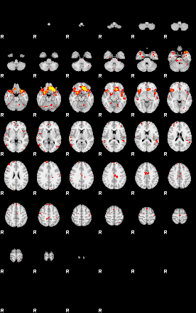 Control:89;component:113