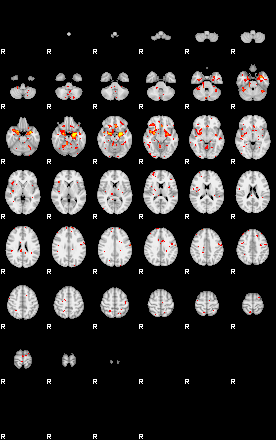 Control:89;component:163