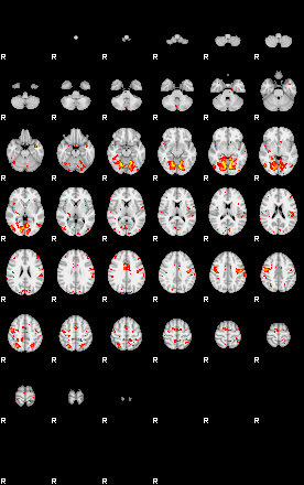 Control:89;component:191