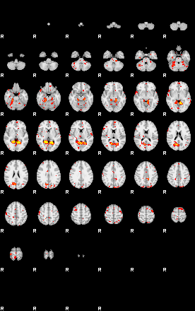 Control:90;component:161