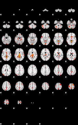 Control:90;component:167