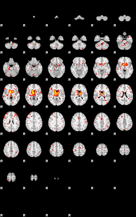 Control:90;component:174