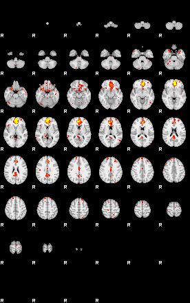 Control:92;component:105