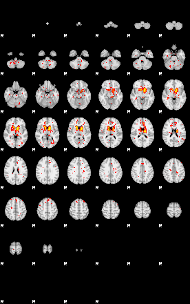 Control:92;component:174