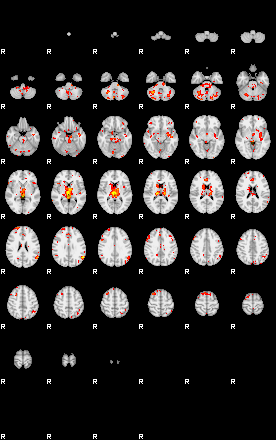 Control:94;component:167