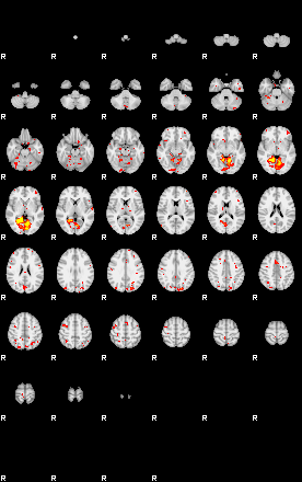 Control:97;component:161