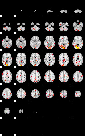 Patient:10;component:30