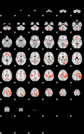 Patient:11;component:21