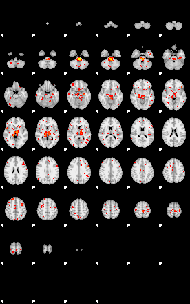 Patient:11;component:32