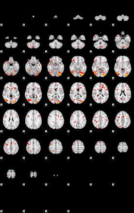 Patient:13;component:111