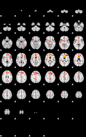 Patient:13;component:125