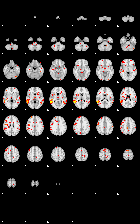 Patient:13;component:131