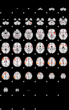 Patient:13;component:138