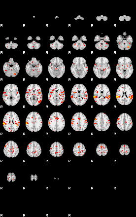 Patient:13;component:150