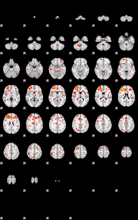 Patient:13;component:200