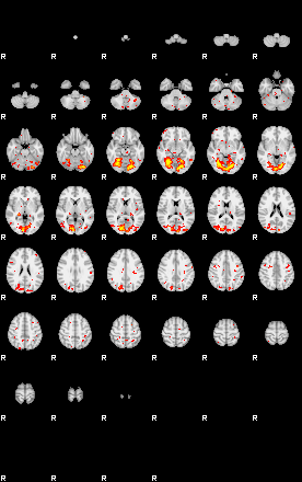 Patient:13;component:30