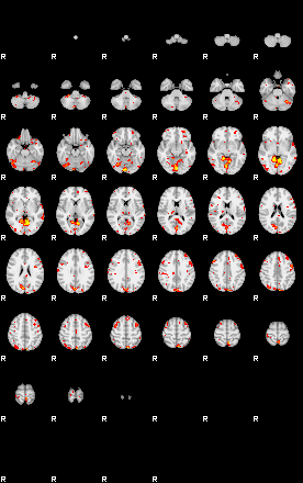 Patient:13;component:5