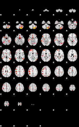 Patient:14;component:115