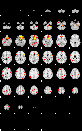 Patient:14;component:144