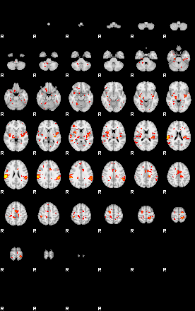 Patient:14;component:150