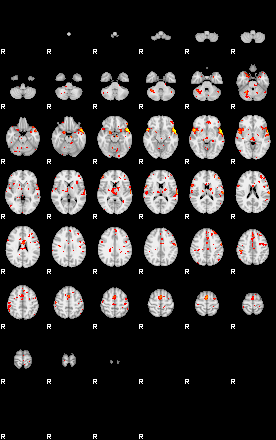 Patient:14;component:41