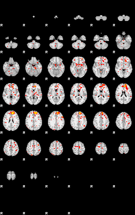 Patient:14;component:44