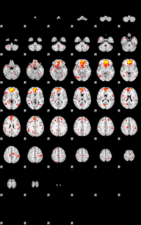 Patient:14;component:49