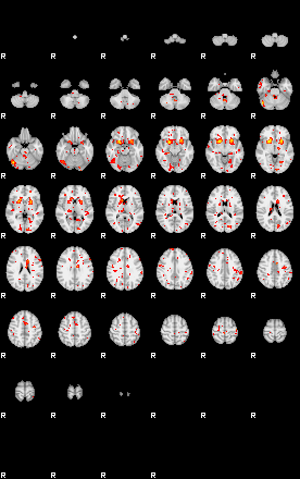 Patient:15;component:18