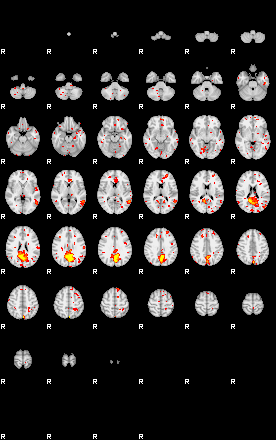 Patient:15;component:9