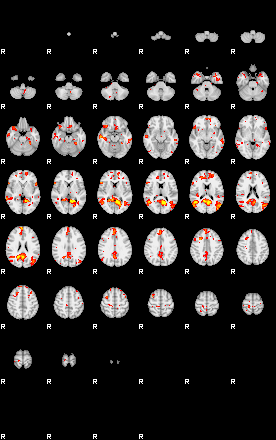 Patient:16;component:100