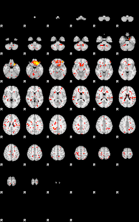 Patient:16;component:113